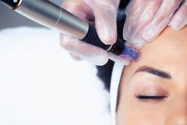 Explaining Total Skin Tightening Treatment and What to Expect 2 What Skin Concerns Can Total Skin Tightening Treatment Help With Birkdale?
